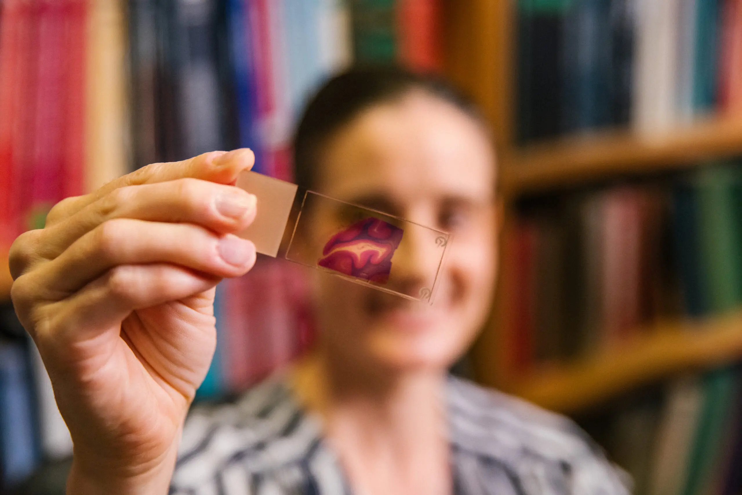 A researcher at the Alzheimer's Disease Research Center (ADRC) holds up a slide of a brain cross-section.