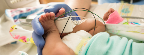 A baby's legs connected to monitors in the NICU.